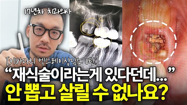 이바다이야기 영상: 내 치아 안 뽑고 살리는 방법은 없을까?